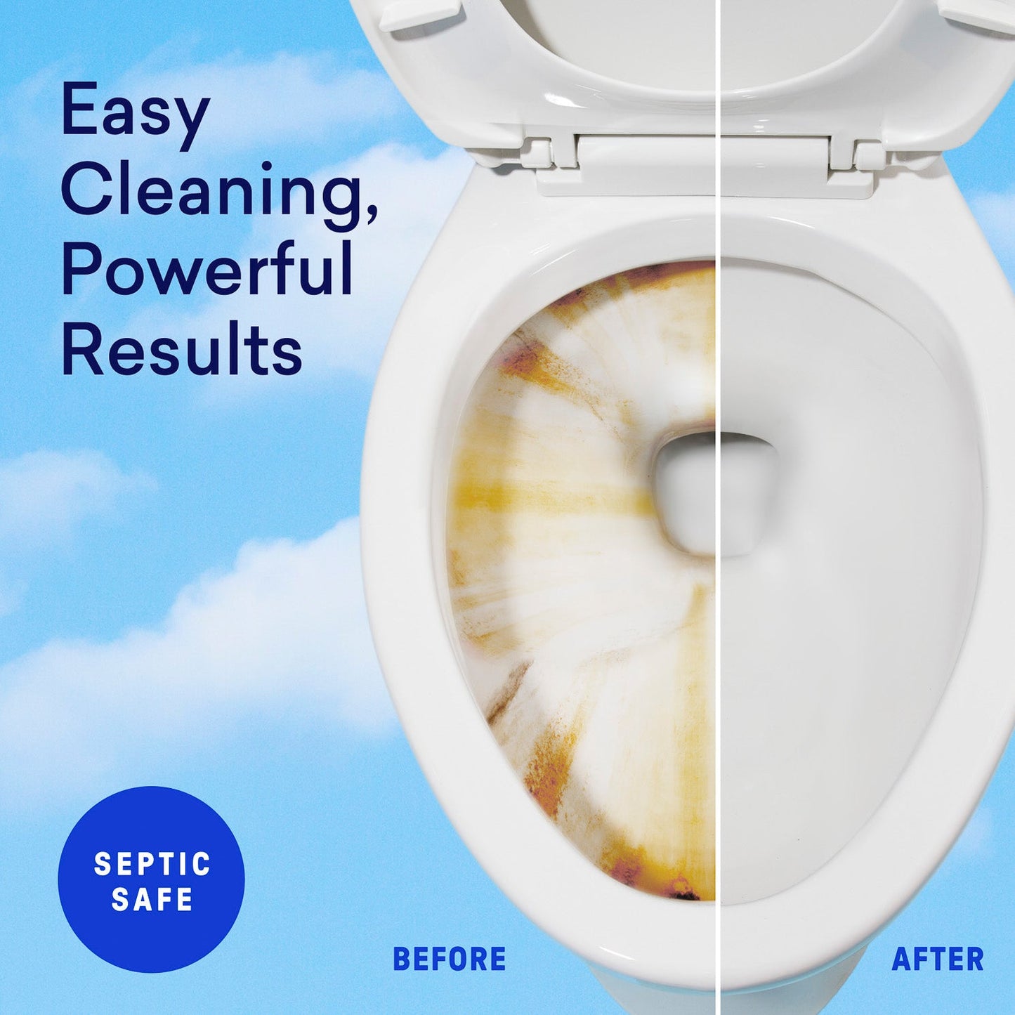 Toilet Bowl Cleaner Starter Set - US 4825